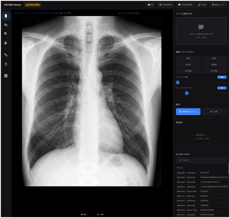 DICOM Viewerの画面