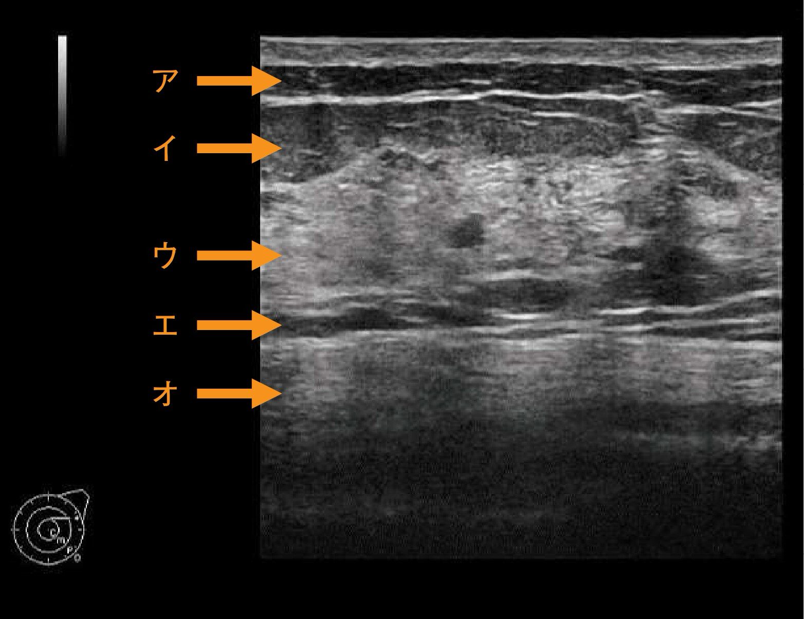 診断用MR装置用ファントム構成