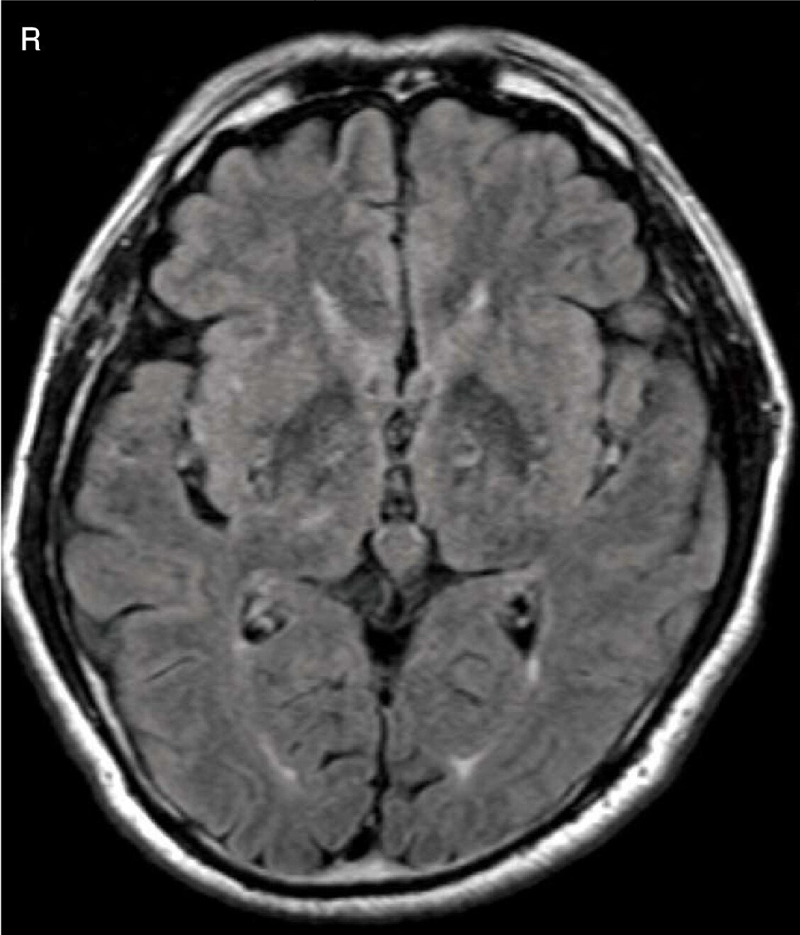診断用MR装置用ファントム構成