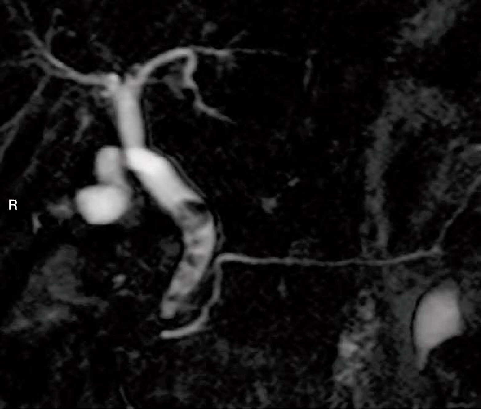 診断用MR装置用ファントム構成