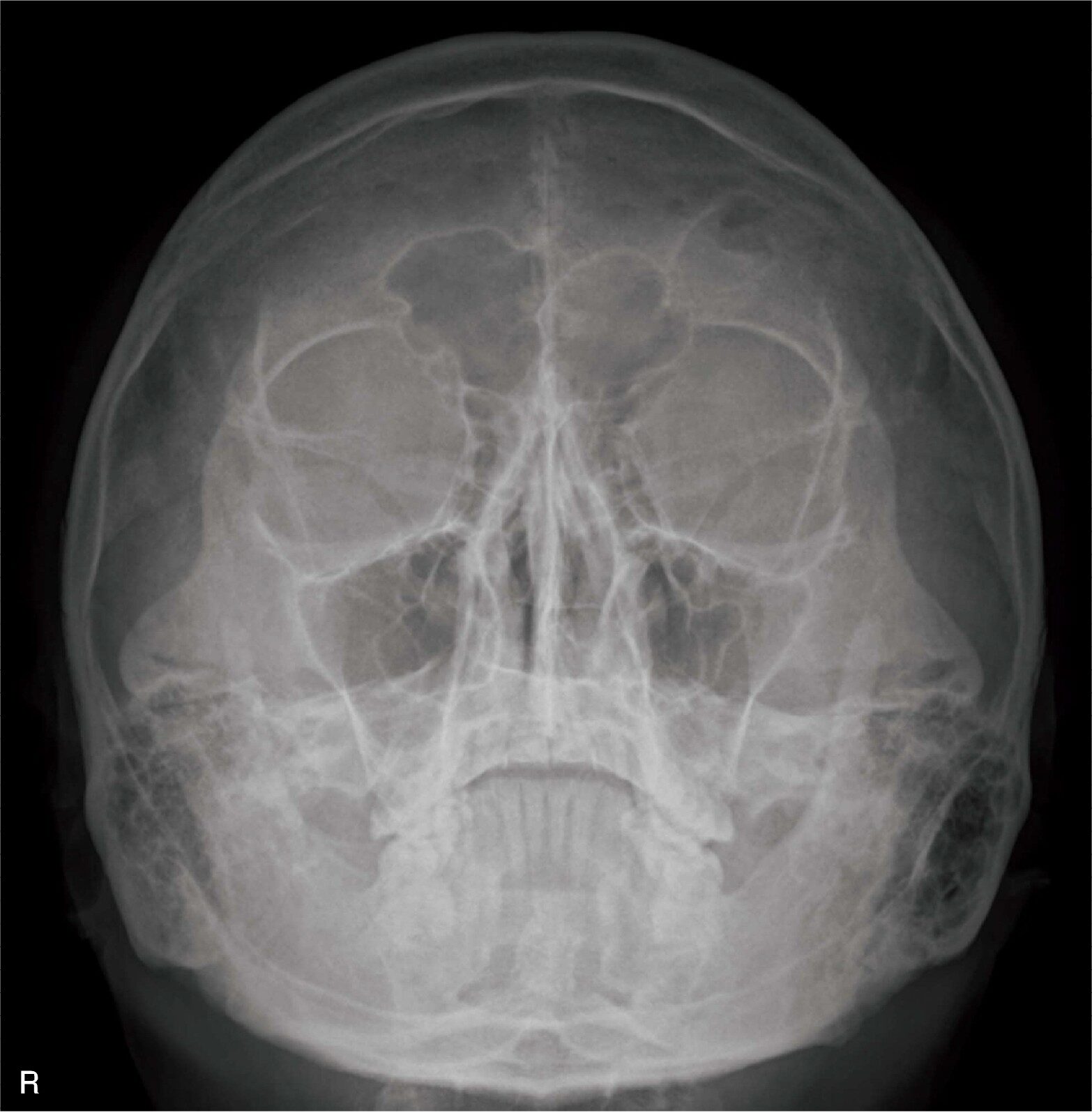 頭部X線写真(別冊No.7)