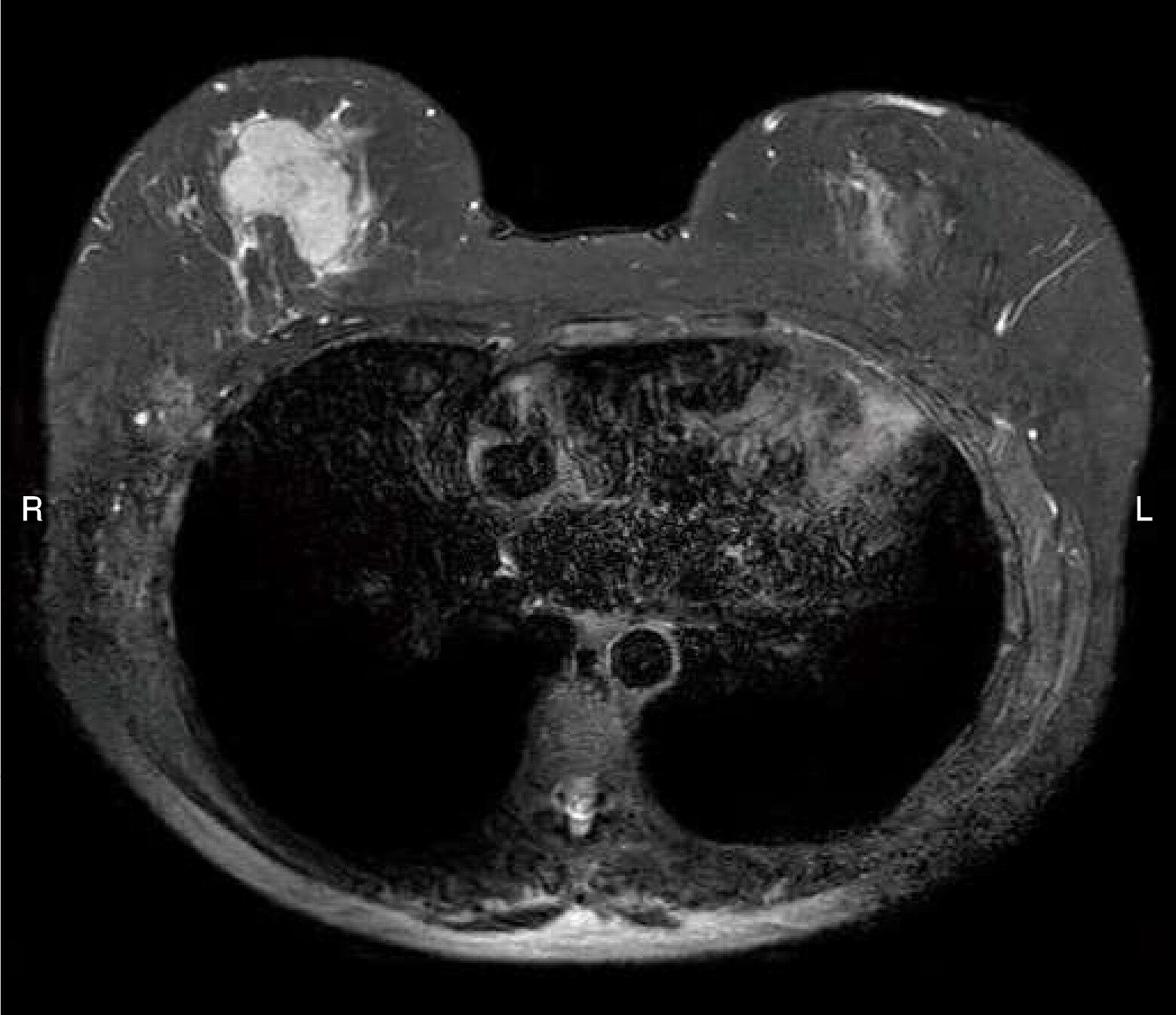 診断用MR装置用ファントム構成