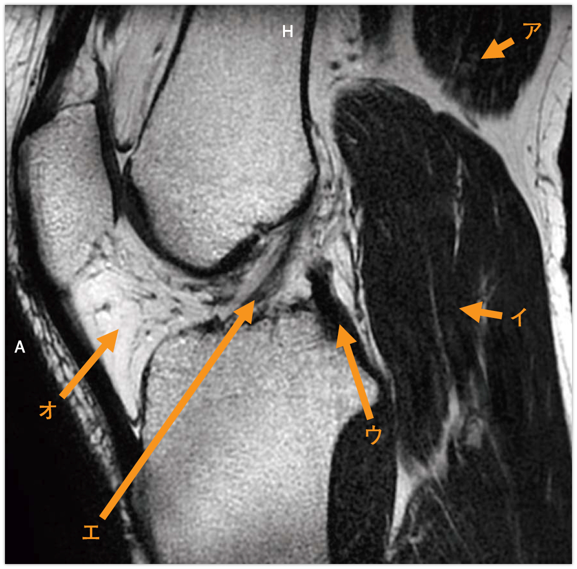 診断用MR装置用ファントム構成
