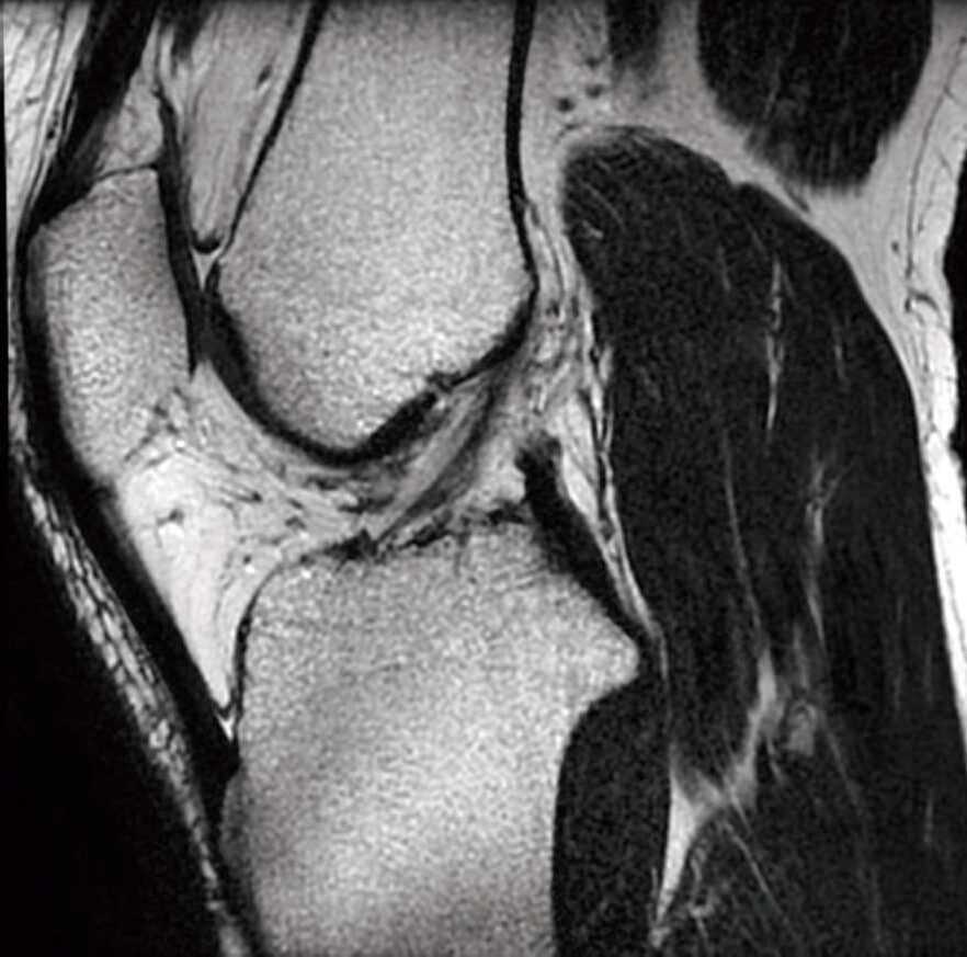 診断用MR装置用ファントム構成