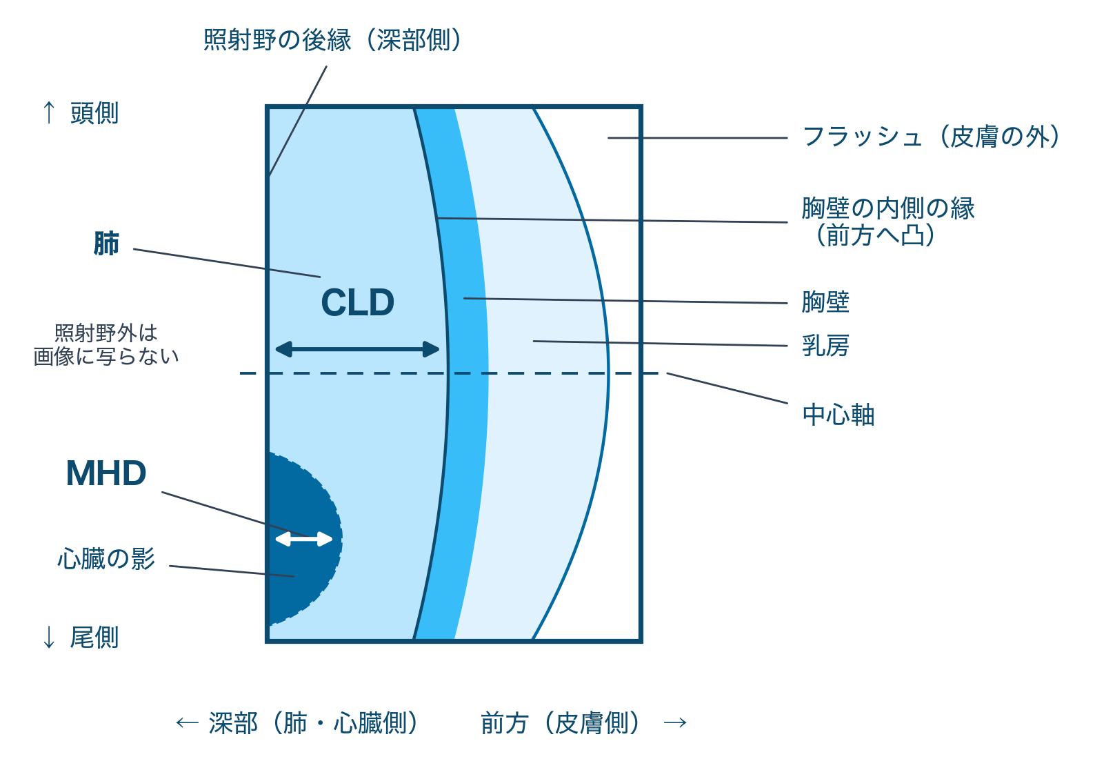 リニアックグラフィ上のCLDとMHDの測り方