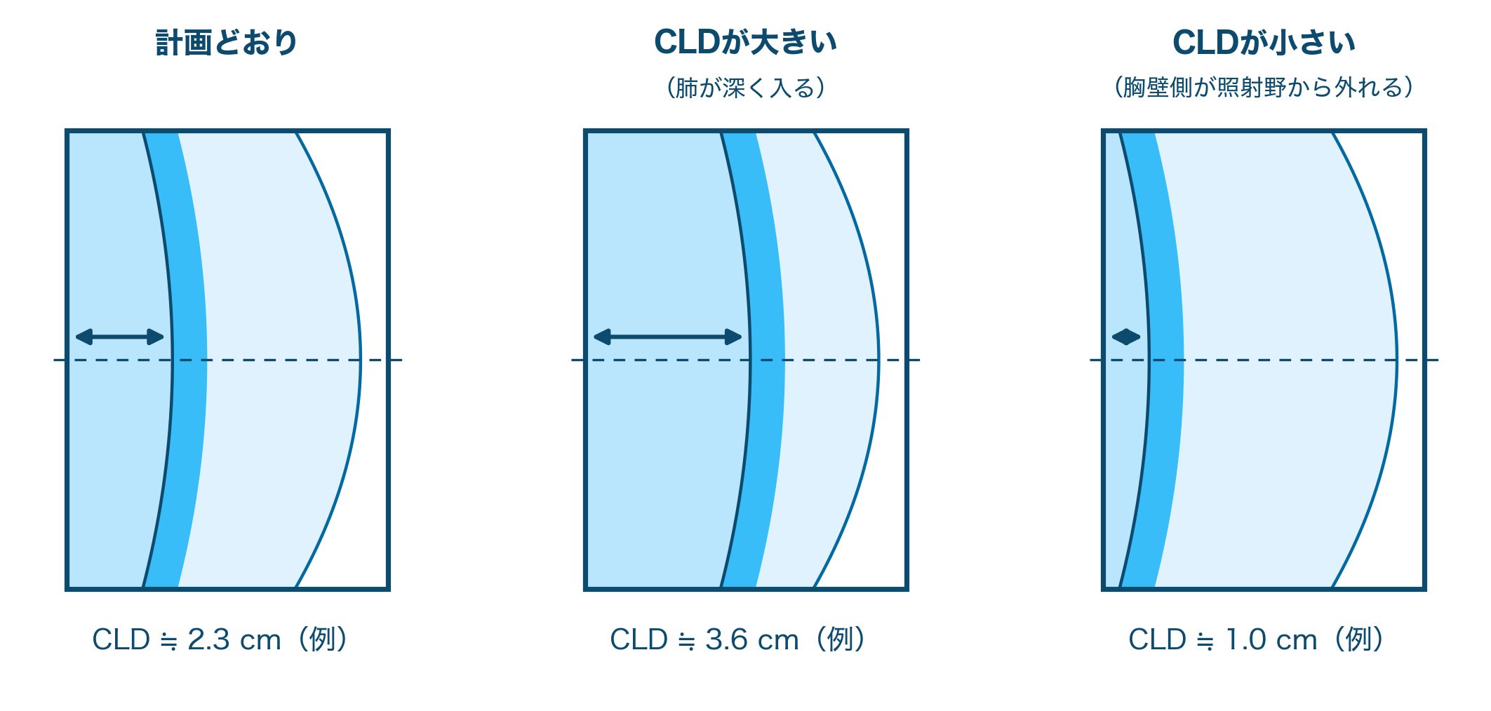 CLDの変化と画像の見え方