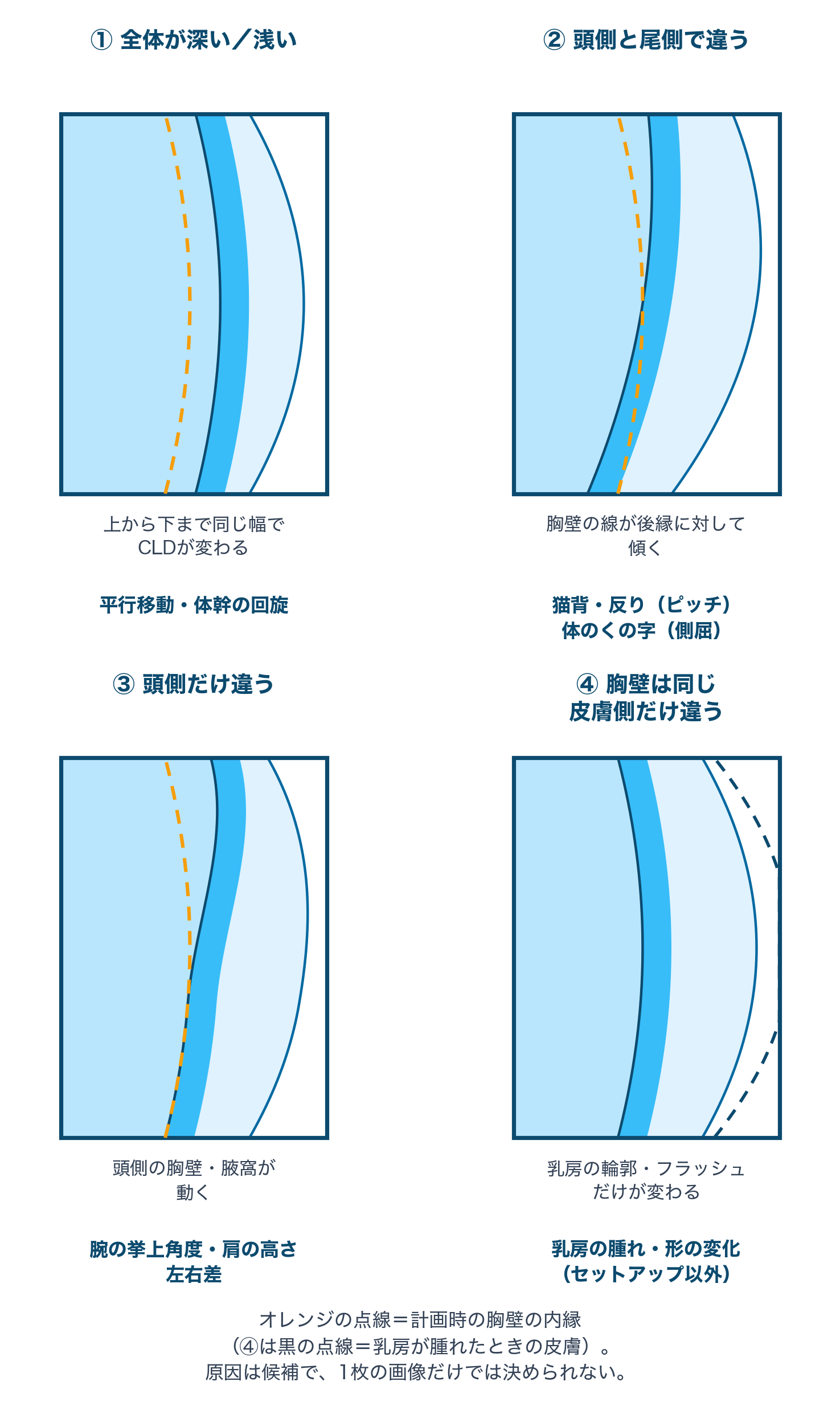リニアックグラフィで見るセットアップずれの4つの型